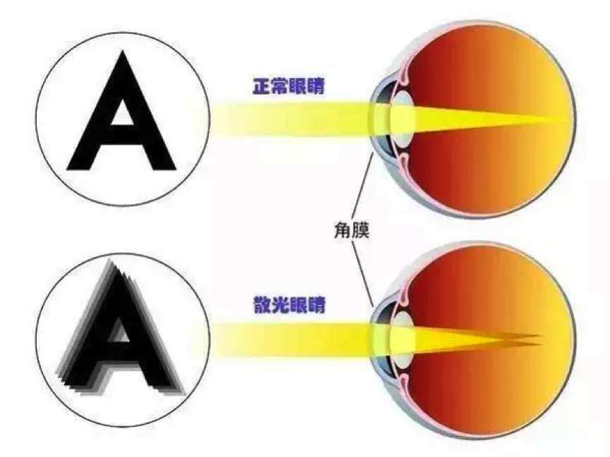 最新视网膜技术，重塑视觉世界的希望之光